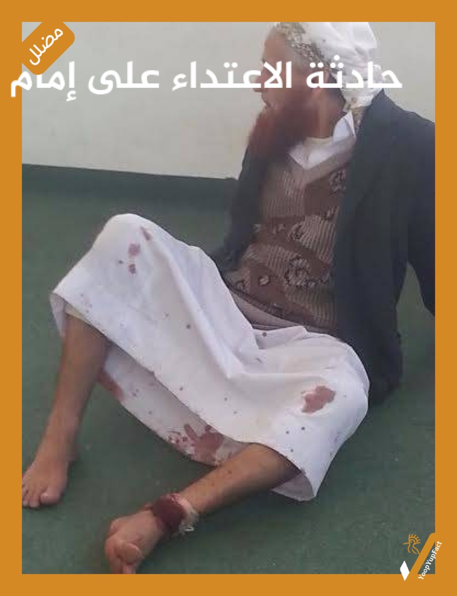 حادثة الاعتداء على إمام مسجد في ذمار تعود لعام 2016 حادثة الاعتداء على إمام مسجد في ذمار تعود لعام 2016